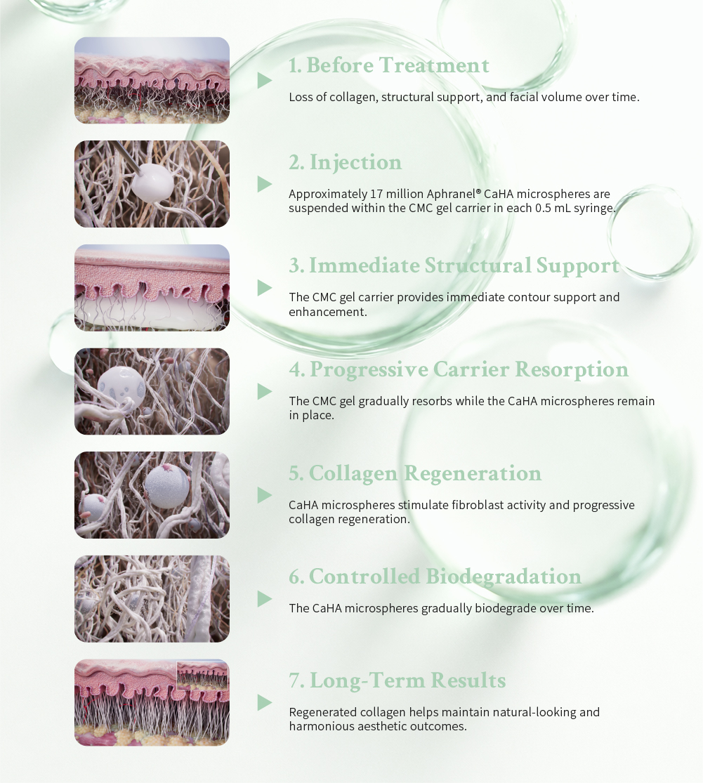 Aphranel MagiCCrystal Novo 7-step mechanism of action: 1. Before Treatment with collagen and volume loss, 2. Injection of 17 million CaHA microspheres in CMC gel, 3. Immediate Structural Support from gel carrier, 4. Progressive Carrier Resorption, 5. Collagen Regeneration via fibroblast stimulation, 6. Controlled Biodegradation of microspheres, 7. Long-Term natural-looking results from regenerated collagen